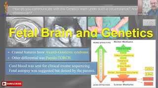 Fetal Brain and Genetics [upl. by Nellir796]