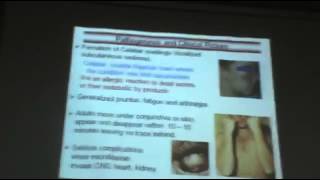 Dr Azza Parasitology Helminths Nematodes 8 Subcutaneous Filaria YouTube [upl. by Earaj]