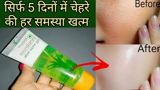 Aloe Vera Gel for fear bright and glowing skin Patanjali Soundarya aloe vera gel skin whitening [upl. by Nepets]