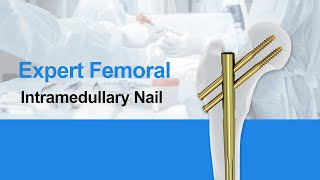 CZMEDITECHExpert Femoral Intramedullary Nail Orthopedics implants intramedullary nail [upl. by Shirley]