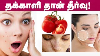 4 முக பிரச்சனைகளுக்கும் தக்காளி தான் தீர்வு  Tomato Face Pack For Skin Whitening in Tamil [upl. by Buffy]