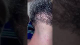 Asmr plucking out ingrown hairs from beards barbershop barber hair shaver ukbarber barberhood [upl. by Wiley]