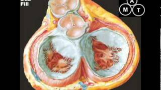 Animated Mitral Regurgitation Murmur [upl. by Azila962]