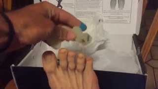 Correct Toes 2 Year Review [upl. by Olvan]