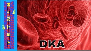 Diabetic Ketoacidosis DKA and Metabolic Acidosis [upl. by Ecinreb]