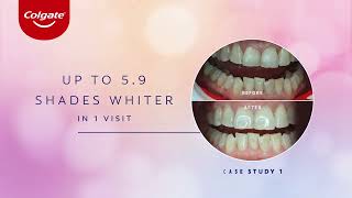 Colgate Optic White LightUp 10 InOffice Whitening Kit [upl. by Yelyak]