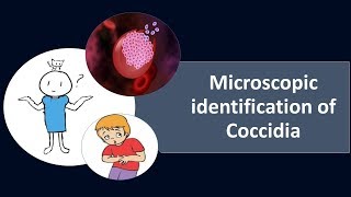 Microscopic identification of CoccidiaMLSCoccidiaParasitologyProtozoa [upl. by Northington]