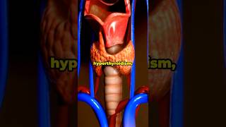 Graves’ Disease  Medical Breakdown gravesdisease hyperthyroidism thyroiddisorders thyroid [upl. by Siuol]