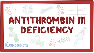 Antithrombin Deficiency Symptoms and Causes  Diagnosis  Treatment  Prevention [upl. by Modesta91]