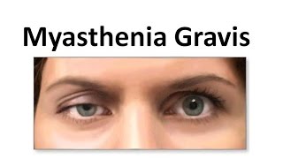 Myasthenia Gravis [upl. by Onairda]