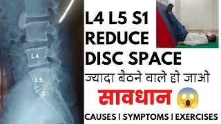 L4L5 and L5S1 reduced disc space exercises in Hindi  Disc space narrowing L5S1 treatment [upl. by Atinaujnas]