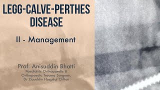 Legg  Calve  Perthes Disease  Management Principle In Depth Lecture by Prof Anisuddin Bhatti [upl. by Llennol]