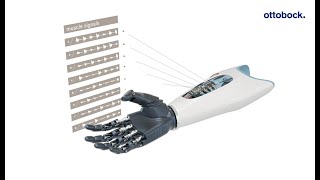 Ottobock Myo Plus pattern recognition The AI control for myoelectric arm prostheses  Ottobock [upl. by Afaw]