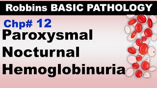 Ch12  Paroxysmal Nocturnal Hemoglobinuria  Blood Pathology  Dr Asif Lectures [upl. by Lobell]