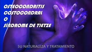 Osteocondritis Síndrome de Tietze [upl. by Notluf]