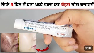 new panderm plus cream reviewpanderm Plus Cream Results in hindipanderm Plus Cream price [upl. by Meirrak]