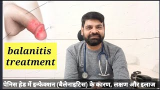 balanitis treatment in hindi  पेनिस हेड में इन्फेक्शन बैलेनाइटिस के कारण लक्षण और इलाज [upl. by Lah]