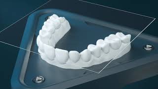 The Next Generation in Clear Aligners  Reveal® [upl. by Keeton]