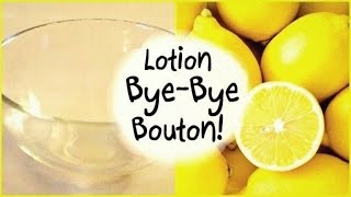 DIY Acné • Lotion Bye Bye Bouton [upl. by Anitsugua]