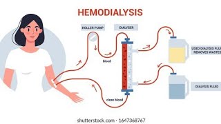 Dialysis and its type by Lecturer Rizwana Naseem [upl. by Ominoreg]