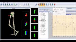 Gait analysis with bluetooth inertial sensors [upl. by Anilef811]