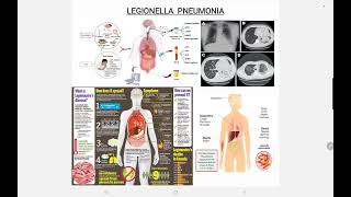 Legionella Pneumonia [upl. by Amri]