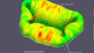 Mitral Valve Simulation [upl. by Nakeber375]