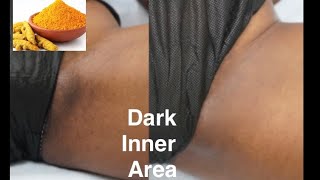 How to get rid of dark inner thighs with Tumeric Diy [upl. by Ahsinik386]