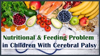 Nutritional amp Feeding Problem in Children With Cerebral Palsy  Trishla Foundation [upl. by Massie]