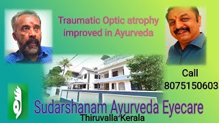 KollamTraumatic post surgical vision loss improved in Ayurvedareview after 3 monthsSudarshanam [upl. by Harlin]