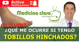 TOBILLOS HINCHADOS Dolor en los Tobillos Causas y soluciones  Medicina Clara [upl. by Noami]