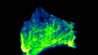 Effect of Latrunculin A on actin [upl. by Unity]