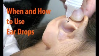 Antibiotic Ear Drops  When and How to Use Ear Drops Properly [upl. by Kaasi]