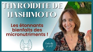 Hypothyroïdie d’Hashimoto régime alimentaire et solutions naturelles [upl. by Jaimie]