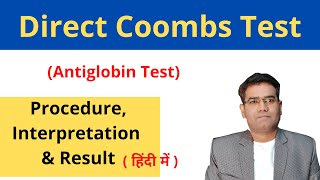 Direct coombs test procedure explained antiglobulin test [upl. by Enyrb]