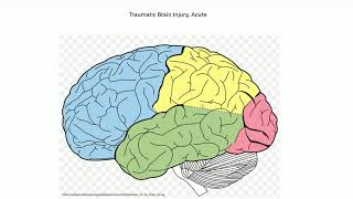 Acute Traumatic Brain Injury  Adventures in Neuropathology [upl. by Dis]