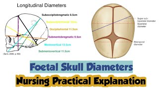 Fetal Skull Diameters  Fetal Skull Anatomy  Pediatric Nursing  Hindi  Nursing Practical [upl. by Mag862]