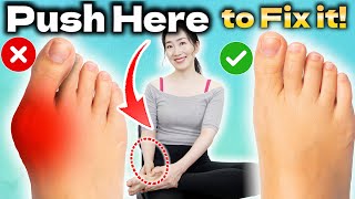 Instant Bunion Pain Relief Massage  How to Fix Bunions Naturally at Home [upl. by Reaht602]