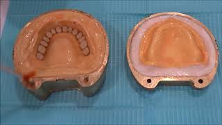 Processing of Complete dentures [upl. by Ednew]