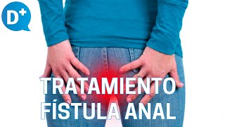 Diagnóstico y tratamiento de la fístula anal [upl. by Annabela]