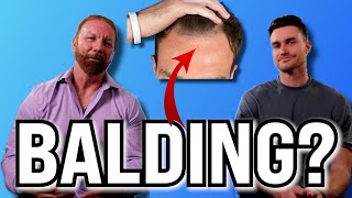 Hair Transplants on the Hair Line vs the Crown Shocking Results [upl. by Carl]