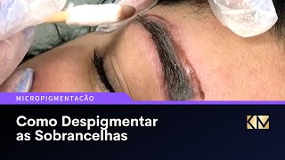 Como Despigmentar as Sobrancelhas Despigmentação Química  micropigmentação [upl. by Ahsilyt]