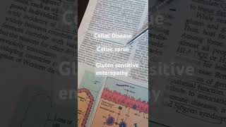 Celiac Disease  Celiac sprue  Gluten sensitive enteropathy gastroenterology glutenintolerance [upl. by Enilrahc]