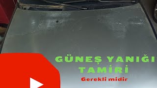 Güneş Yanığı Nasıl Düzelir Boyasız Verniksiz düzelir mi Bilmeniz Gerekenler [upl. by Dill]