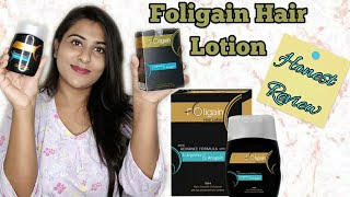 Foligain Hair Lotion Review  Honest Review  Does It Really Works  The Shubhi Tips [upl. by Mauchi]