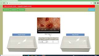 Experiment 22 Study of anti ulcer activity  using pylorus ligation method or SHAY method [upl. by Sierra]