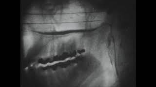 Cine fluorography of cleft palate speech  The Johns Hopkins Medical Institutions circa 1956 [upl. by Eedak828]