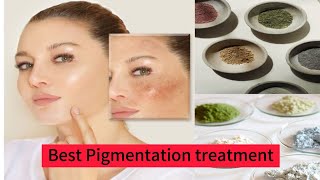 How To Treat Melasma l Best Melasma And Hyperpigmentation Treatment l Glowup With Aroob [upl. by Hgielrac]