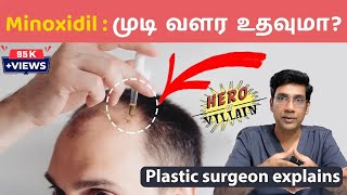 முடி வளர்ச்சிக்கு மினாக்ஸிடில் எப்படி பயன்படுத்துவது Minoxidil  Hair Loss clinic coimbatore [upl. by Ihab]