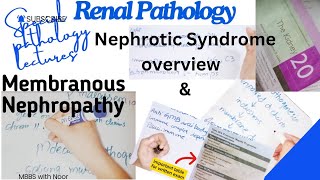 membranous nephropathy  nephrotic syndrome  renal pathology lectures  selflessmedicose [upl. by Olnee311]